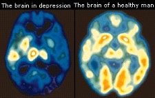 What is Depression Help?